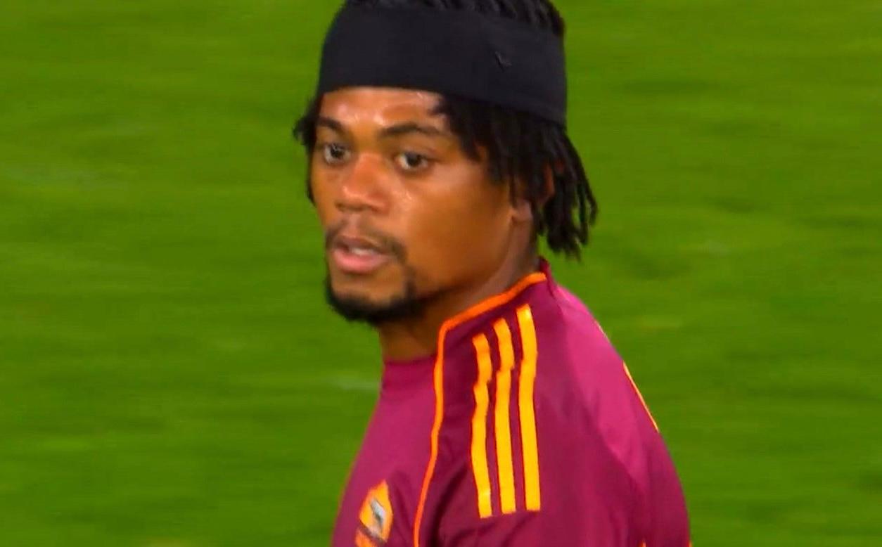 Bailey, tra sfortuna e ironia social: “Sembra Gervinho” – FOTO